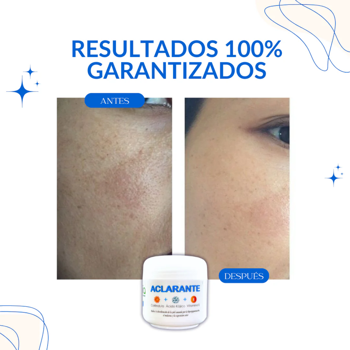 Crema Blanqueadora |𝘾𝙤𝙢𝙥𝙧𝙖 𝟭 𝙮 𝙡𝙡𝙚́𝙫𝙖𝙩𝙚 𝙚𝙡 𝙨𝙚𝙜𝙪𝙣𝙙𝙤 𝙂𝙍𝘼𝙏𝙄𝙎 | ¡𝙋𝙍𝙊𝙈𝙊𝘾𝙄𝙊́𝙉 𝘿𝙀 𝘿𝙄𝙎𝙋𝙊𝙉𝙄𝘽𝙄𝙇𝙄𝘿𝘼𝘿 𝘿𝙀 𝙎𝙏𝙊𝘾𝙆!